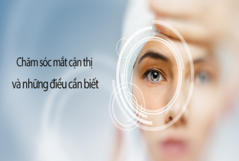 Chăm sóc mắt cận thị và những điều cần biết