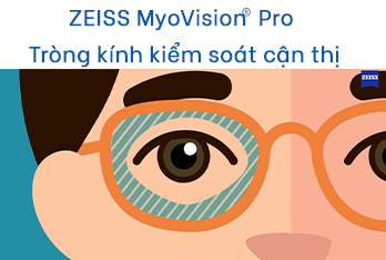 Tròng kính ZEISS MyoVision® Pro kiểm soát cận thị
